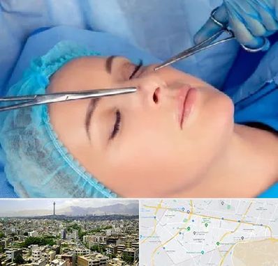 عمل بینی نیمه فانتزی در منطقه 8 تهران 