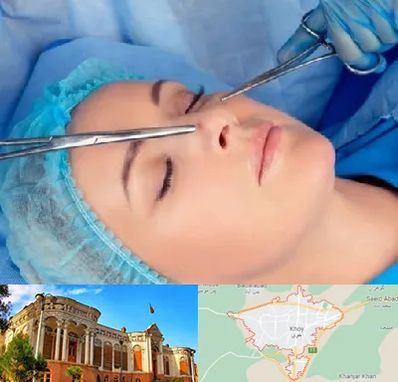 عمل بینی نیمه فانتزی در خوی