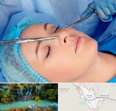 عمل بینی نیمه فانتزی در دورود