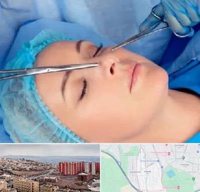 عمل بینی نیمه فانتزی در سهند تبریز