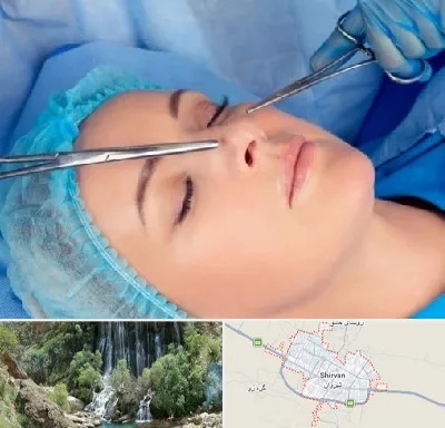 عمل بینی نیمه فانتزی در شیروان