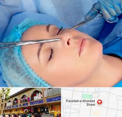 عمل بینی نیمه فانتزی در 15 خرداد