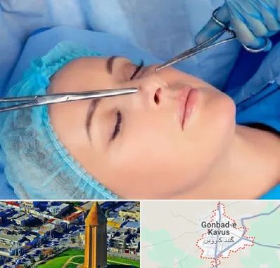 عمل بینی نیمه فانتزی در گنبد کاووس