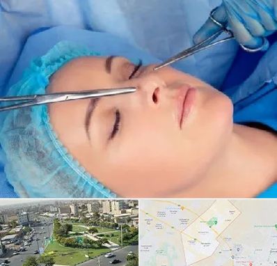 عمل بینی نیمه فانتزی در کمال شهر کرج