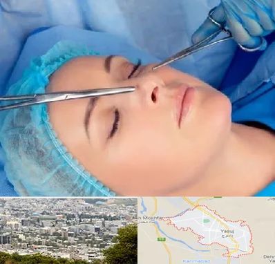 عمل بینی نیمه فانتزی در یاسوج