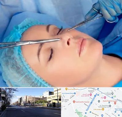 عمل بینی نیمه فانتزی در خیابان ملاصدرا شیراز