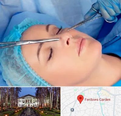 عمل بینی نیمه فانتزی در باغ فردوس