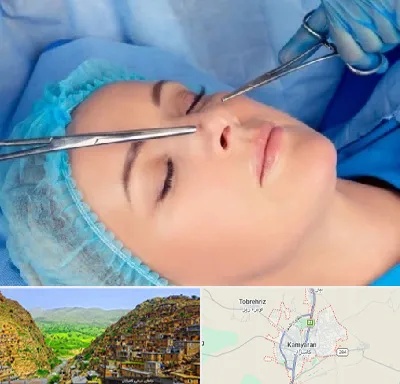عمل بینی نیمه فانتزی در کامیاران