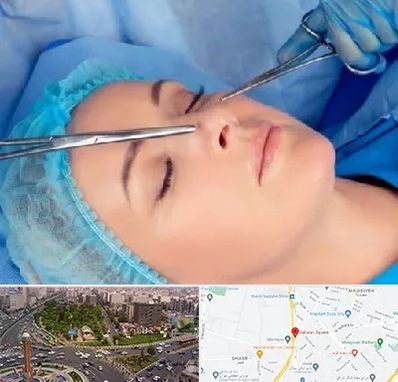 عمل بینی نیمه فانتزی در سبلان 