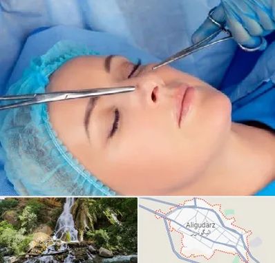عمل بینی نیمه فانتزی در الیگودرز