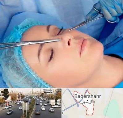 عمل بینی نیمه فانتزی در باقرشهر