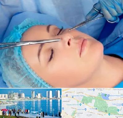 عمل بینی نیمه فانتزی در چیتگر 