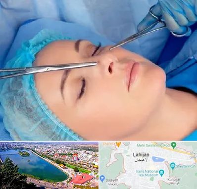 عمل بینی نیمه فانتزی در لاهیجان