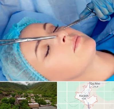 عمل بینی نیمه فانتزی در کلاله
