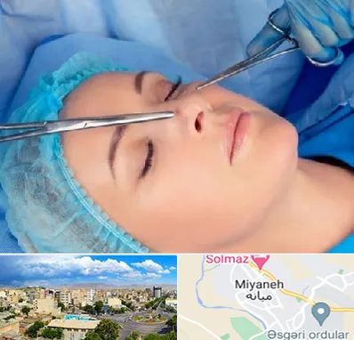 عمل بینی نیمه فانتزی در میانه