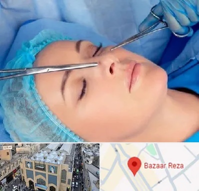 عمل بینی نیمه فانتزی در بازار رضا مشهد