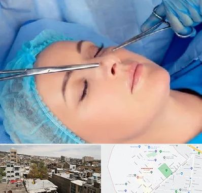 عمل بینی نیمه فانتزی در شمیران نو