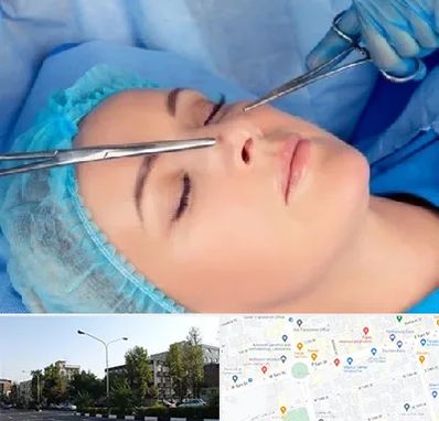 عمل بینی نیمه فانتزی در میدان کاج 