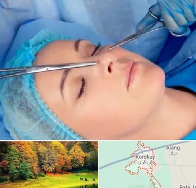 عمل بینی نیمه فانتزی در کردکوی