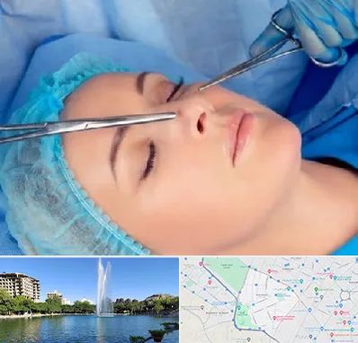 عمل بینی نیمه فانتزی در کوهسنگی مشهد