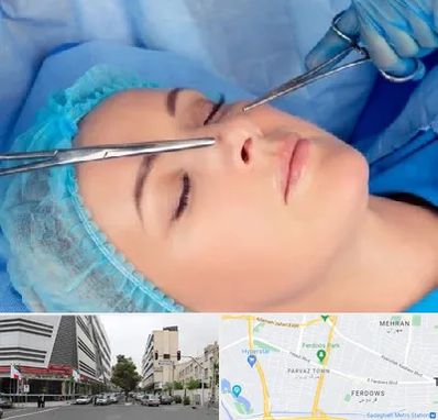 عمل بینی نیمه فانتزی در بلوار فردوس 