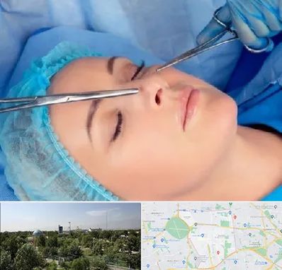 عمل بینی نیمه فانتزی در منطقه 16 تهران 