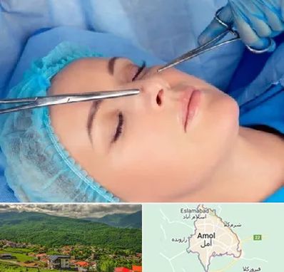 عمل بینی نیمه فانتزی در آمل