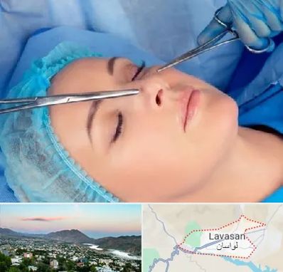 عمل بینی نیمه فانتزی در لواسان