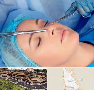 عمل بینی نیمه فانتزی در شاهین شهر