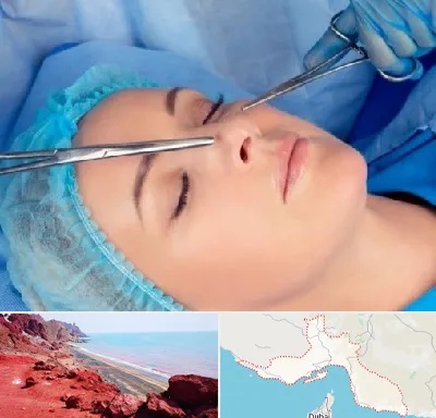 عمل بینی نیمه فانتزی در هرمزگان