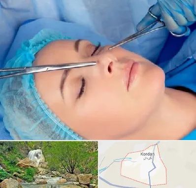 عمل بینی نیمه فانتزی در کردان