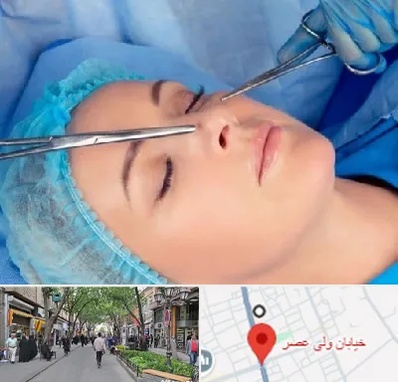 عمل بینی نیمه فانتزی در ولیعصر شهریار