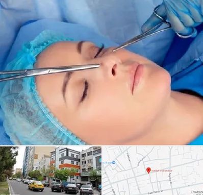 عمل بینی نیمه فانتزی در هفده شهریور تبریز