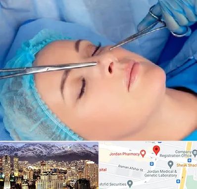 عمل بینی نیمه فانتزی در جردن 