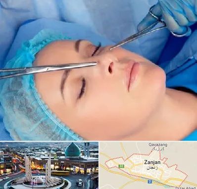 عمل بینی نیمه فانتزی در زنجان