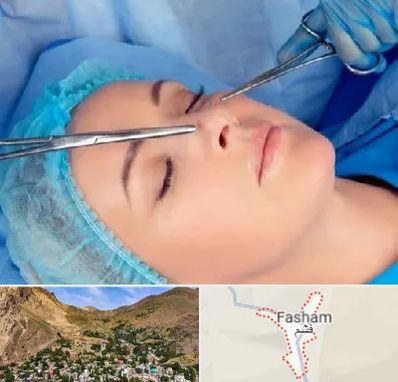 عمل بینی نیمه فانتزی در فشم