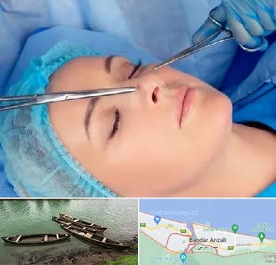 عمل بینی نیمه فانتزی در بندر انزلی