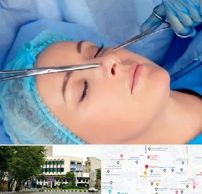 عمل بینی نیمه فانتزی در طالقانی 