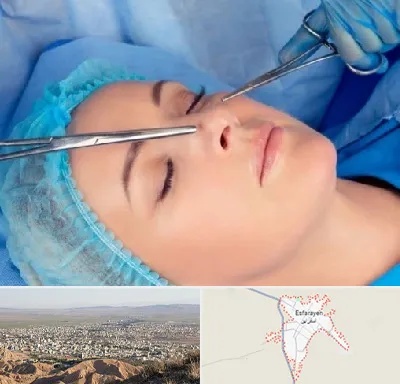عمل بینی نیمه فانتزی در اسفراین