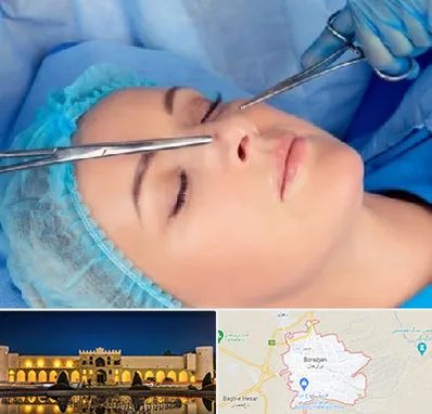 عمل بینی نیمه فانتزی در برازجان