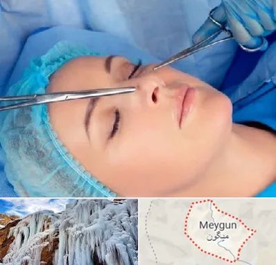 عمل بینی نیمه فانتزی در میگون