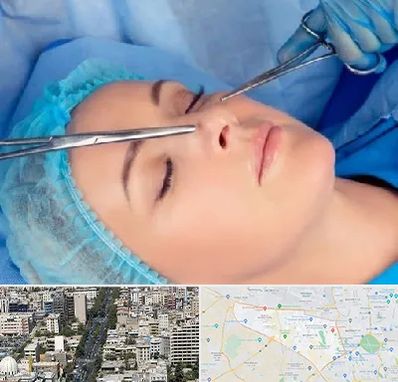 عمل بینی نیمه فانتزی در منطقه 18 تهران 