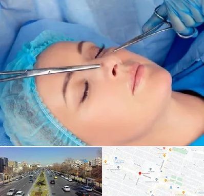 عمل بینی نیمه فانتزی در بلوار معلم مشهد