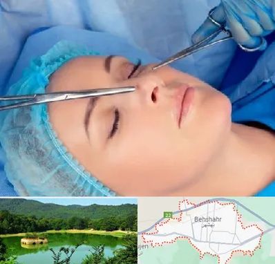 عمل بینی نیمه فانتزی در بهشهر