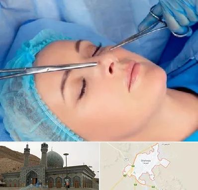 عمل بینی نیمه فانتزی در شهرضا