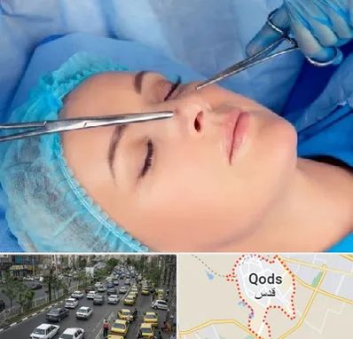 عمل بینی نیمه فانتزی در شهر قدس