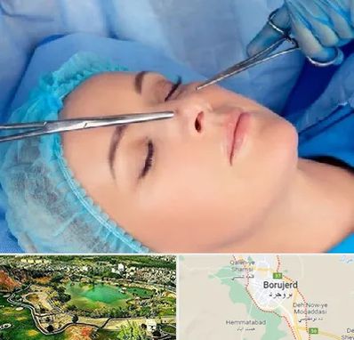 عمل بینی نیمه فانتزی در بروجرد