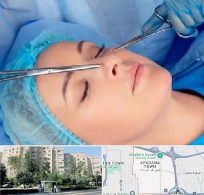 عمل بینی نیمه فانتزی در آپادانا