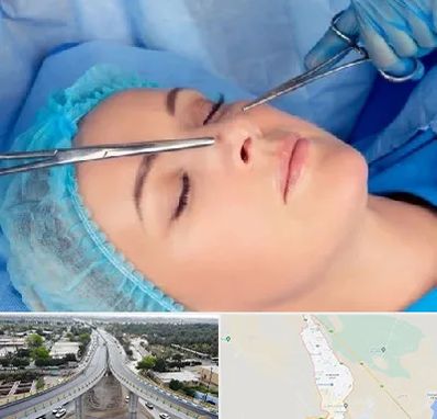 عمل بینی نیمه فانتزی در اندیمشک