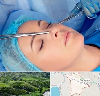 عمل بینی نیمه فانتزی در گچساران